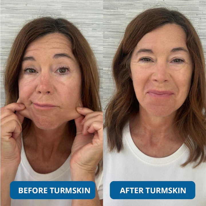 💧 3% Hyaluronic Acid Ultra-Hydrating Serum Flood Your Skin With Glass-Skin Hydration Instantly ✨