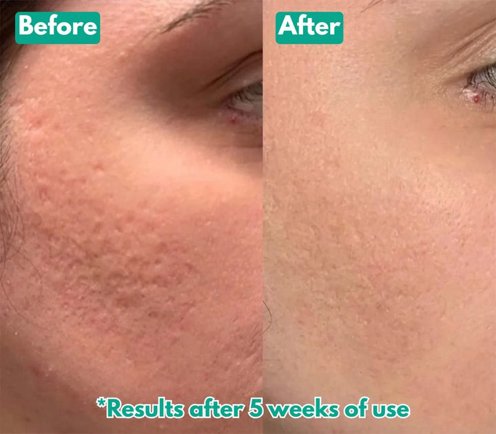 🏆Flash Sale⚡ Microcrystal™ Serum PM Duo