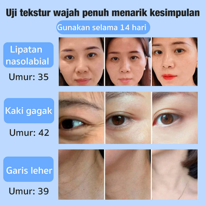 🎉Last Day Promotion - 49% OFF🎉Japanese Anti-wrinkle Rejuvenation Cream