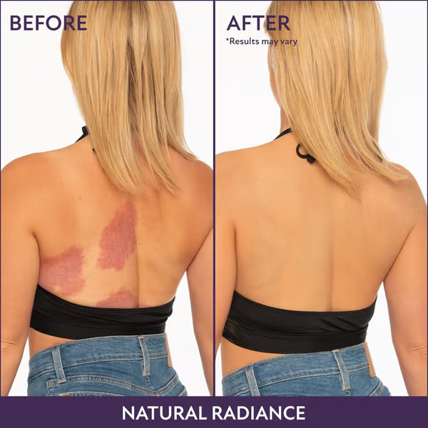 🎉Buy 1 get 1 free🔥Body Coverage Perfector