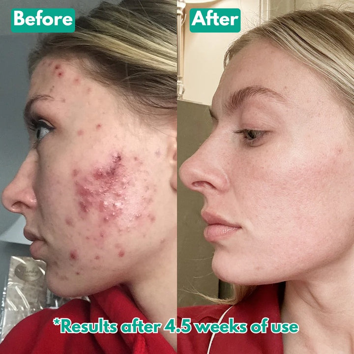 🏆Flash Sale⚡ Microcrystal™ Serum PM Duo