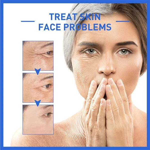 Last Day Promotion 49% OFF--2024 New Collagen Boost Anti-Aging Serum