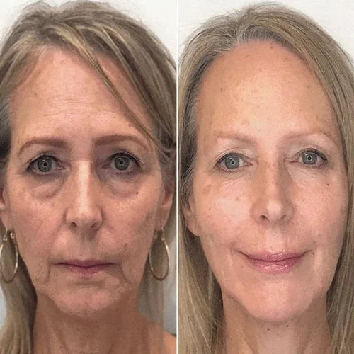 🔥Last Day Promotion 49% OFF🔥Face Boost Anti-Aging Serum