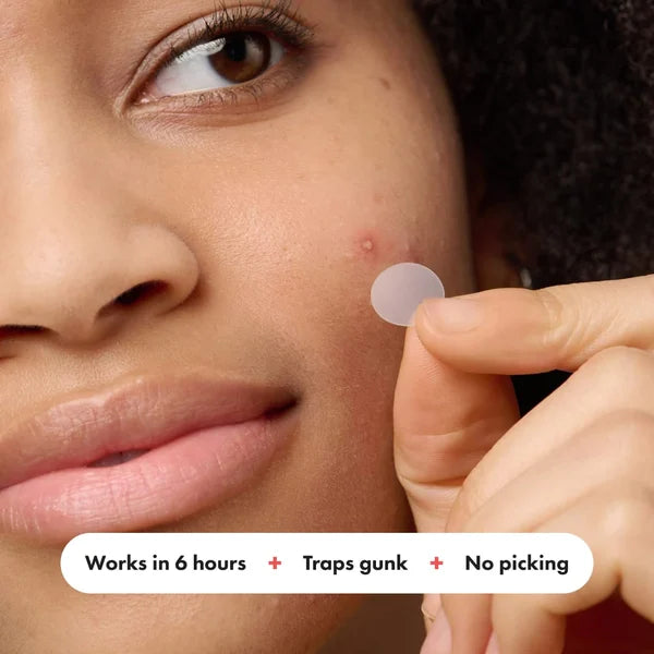 ✨ 2024 Hydrocolloid Acne Cover Patches（🔥Buy 3 Get 3 Free）