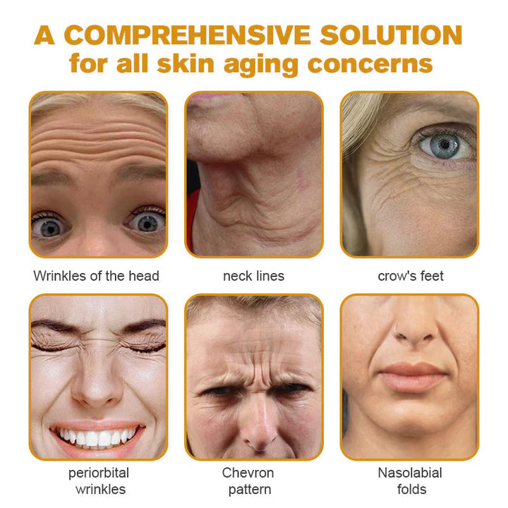 Botox Bee Venom Wrinkle Removal Cream