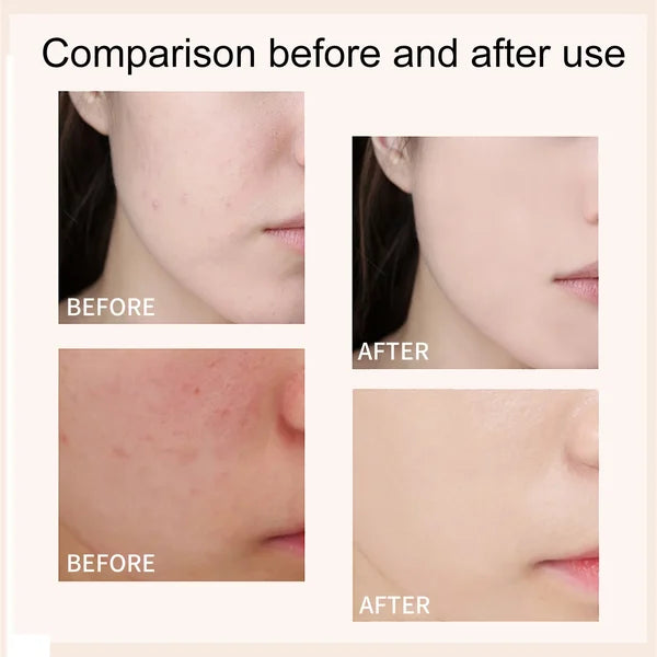 Last Day Promotion 49% OFF - 🔥Skin Tone Adjusting CC Cream SPF 43