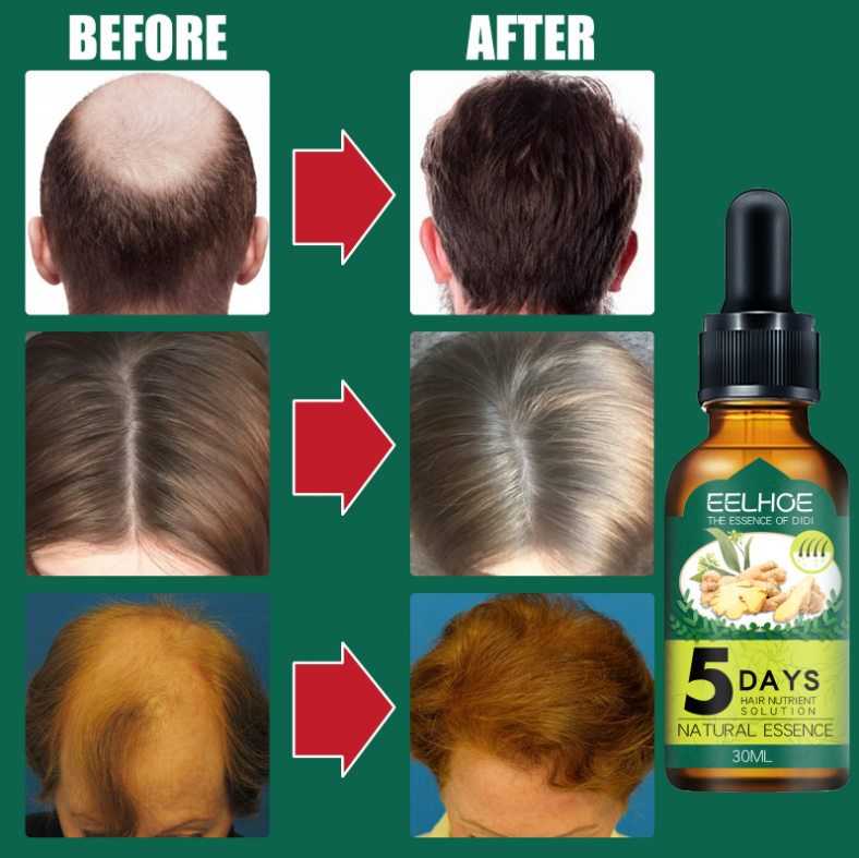 2024 New Ginger Hair Oil