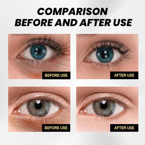 🎁Last Day 50% SALE OFF - Fast Firming Eye Cream🔥